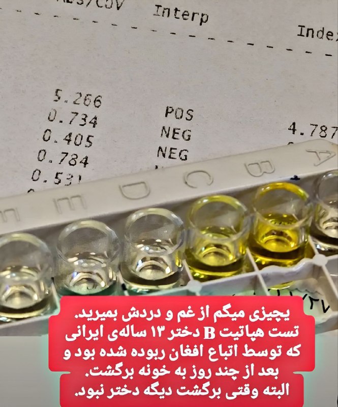 ***🔻*** واقعا هیچ توضیحی نیست