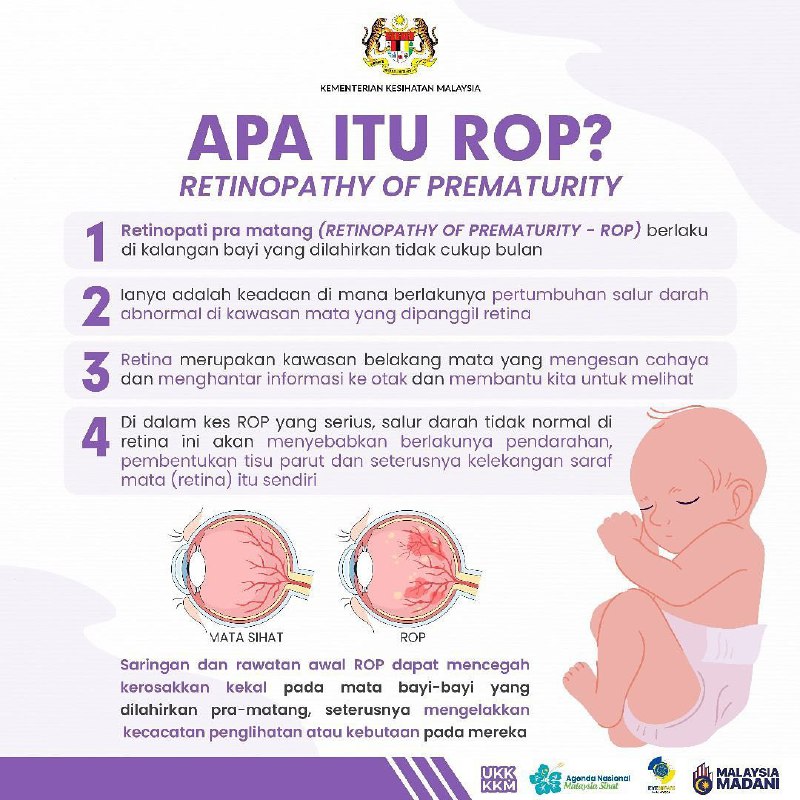 ***👶******✨*** Retinopathy of Prematurity (ROP) adalah …