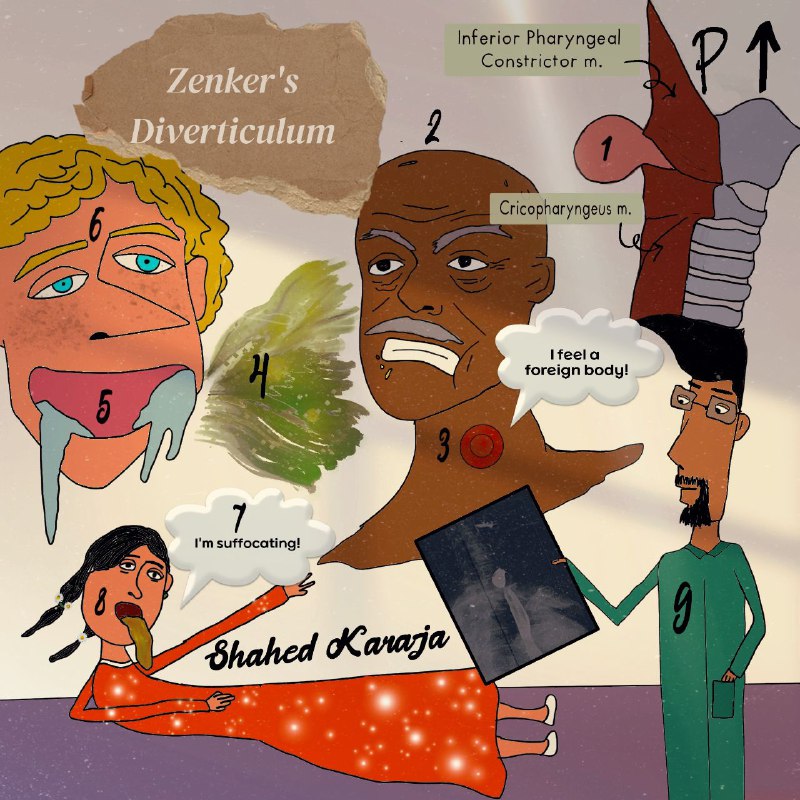 [**#sketchy**](?q=%23sketchy) **{Zenker's Diverticulum} ***?*****