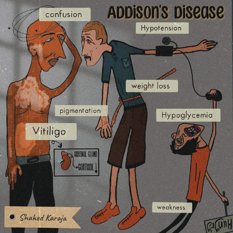 [**#sketchy**](?q=%23sketchy) **{Addison's Disease}***?️*****
