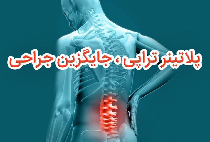 *****?*** جراحی کمر ممنوع شد ! …