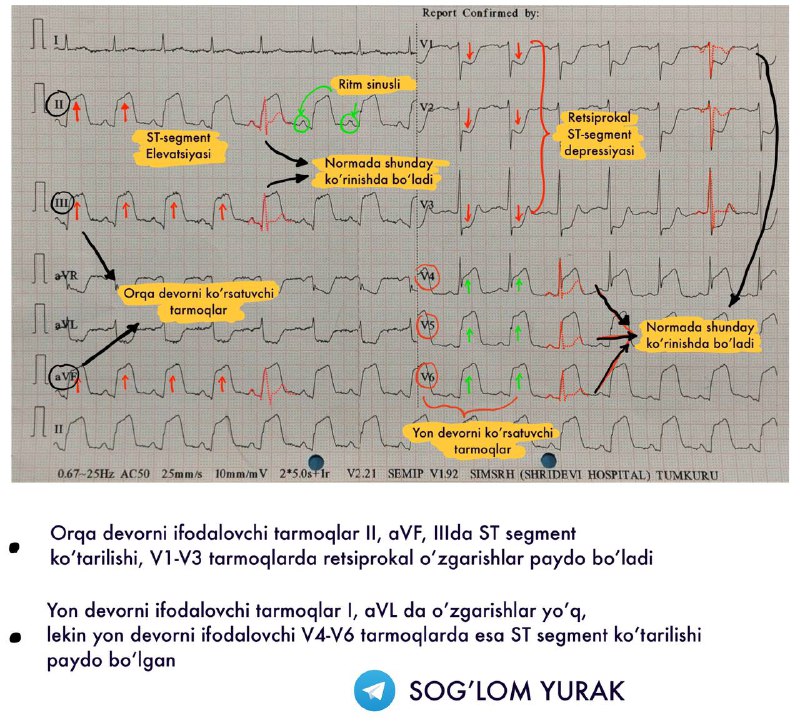 Sog’lom Yurak Kardiologiya