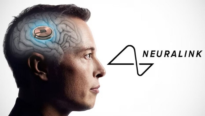 ***🤯*** **Мозговые чипы Neuralink начнут вживлять …