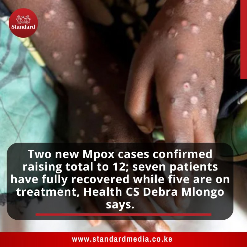 Two new Mpox cases confirmed raising …