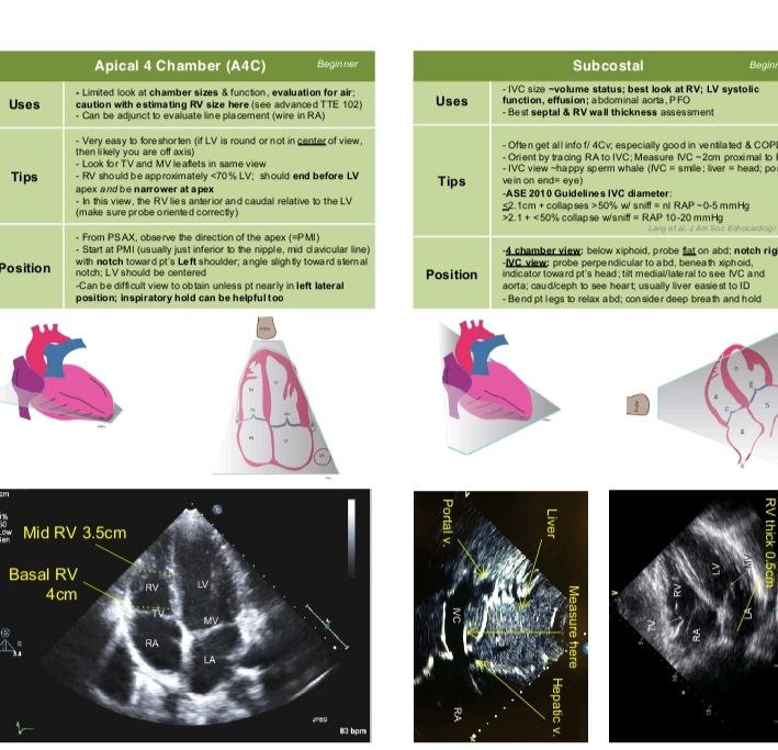 دورة الإيكو *point of care Ultrasound …