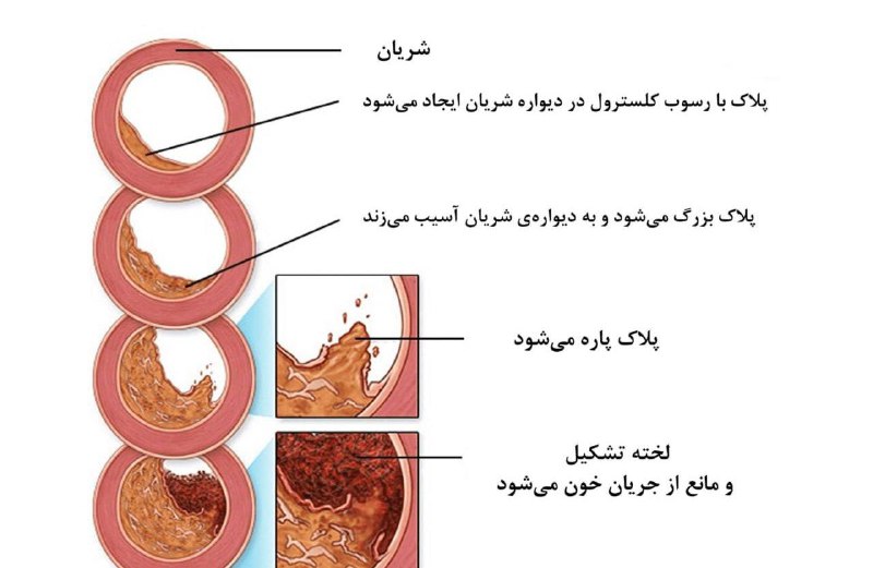 5 روشی که بدن به شما …