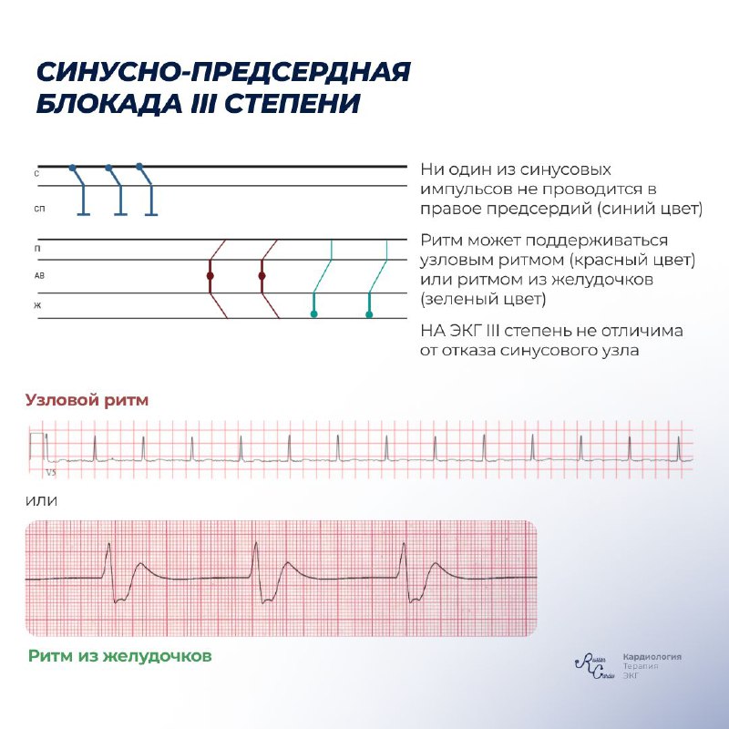 Ruslan_cardio