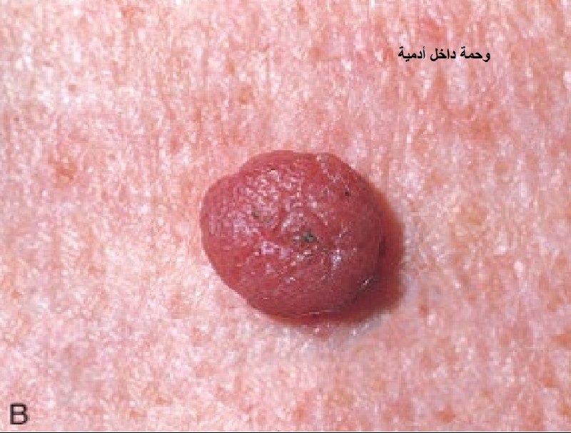 2.الصورة العيانية