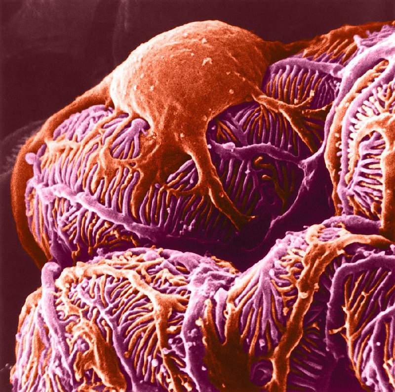 ● Les podocytes :-)