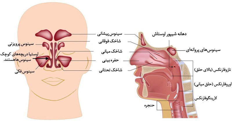 **درمان سینوزیت:**