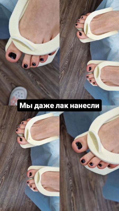 Подолог Педикюр Сочи👌