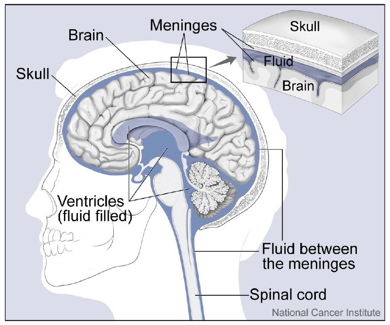 ***?*** **Aseptic meningitis**