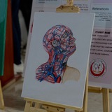 تَروِيقة مَزنُوقين .