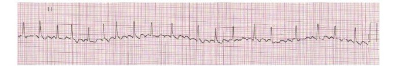 [#EKG\_Kardiologiya](?q=%23EKG_Kardiologiya)