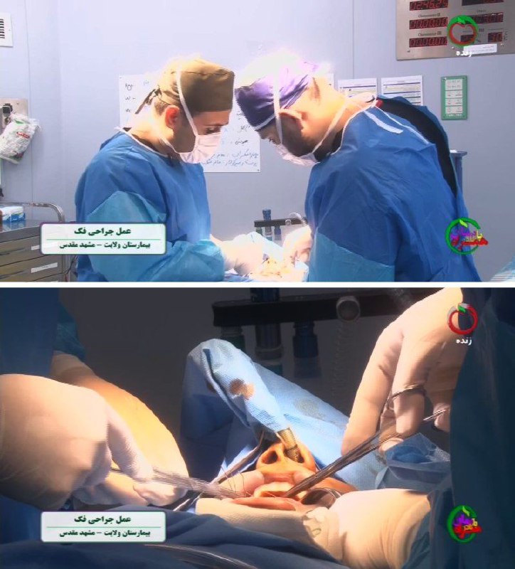 **پوشش تلویزیونی عمل جراحی**
