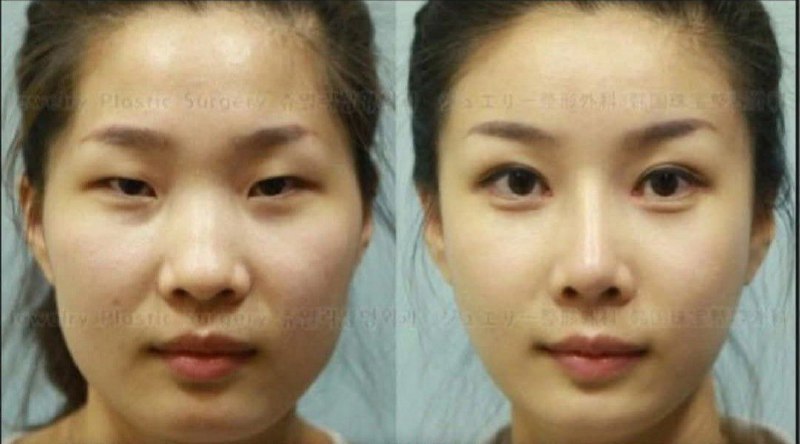 South Korean plastic surgeons are so …