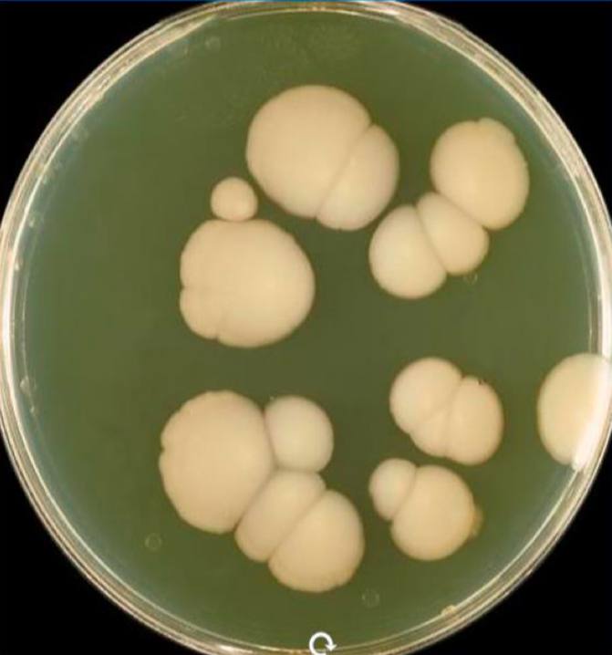 Large white colonies of ***Candida albicans*** …