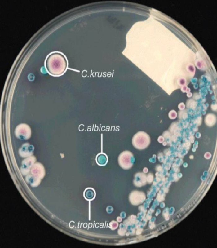 **Chromogenic agar**