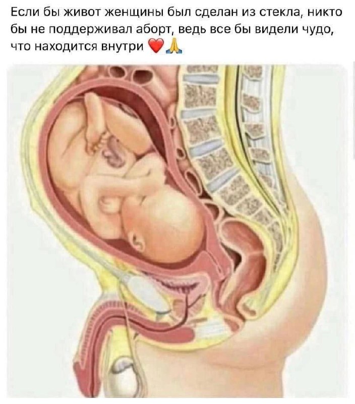 УРАЛМЕМЗАВОД