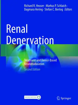 Renal Denervation - Treatment and Device-Based …