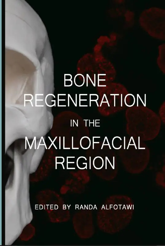 **Bone Regeneration in the Maxillofacial Region …