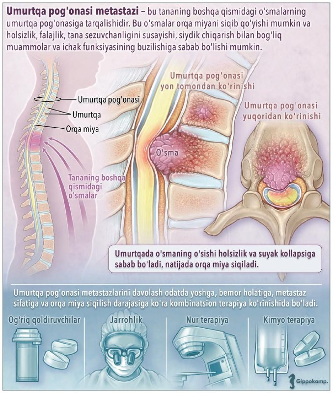 ***?*** Patologik anatomiyadan neoplaziya va metastazni …