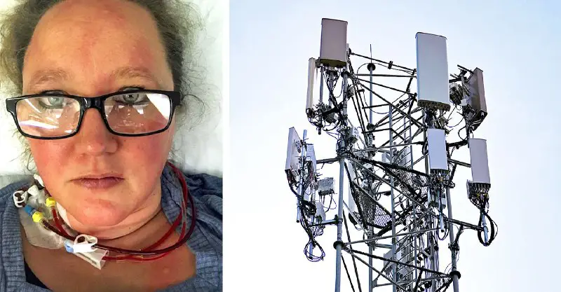 ***🚨*** Exclusive: Woman Living Near Cell Tower Diagnosed With 51 Strokes