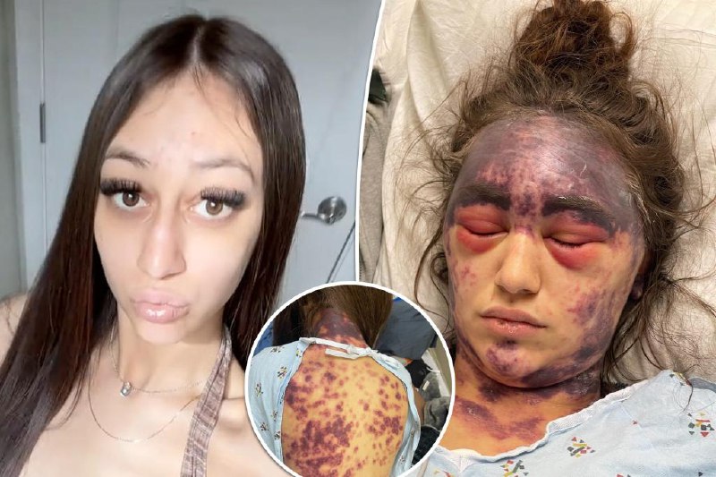 Woman with rare disease claims she's …