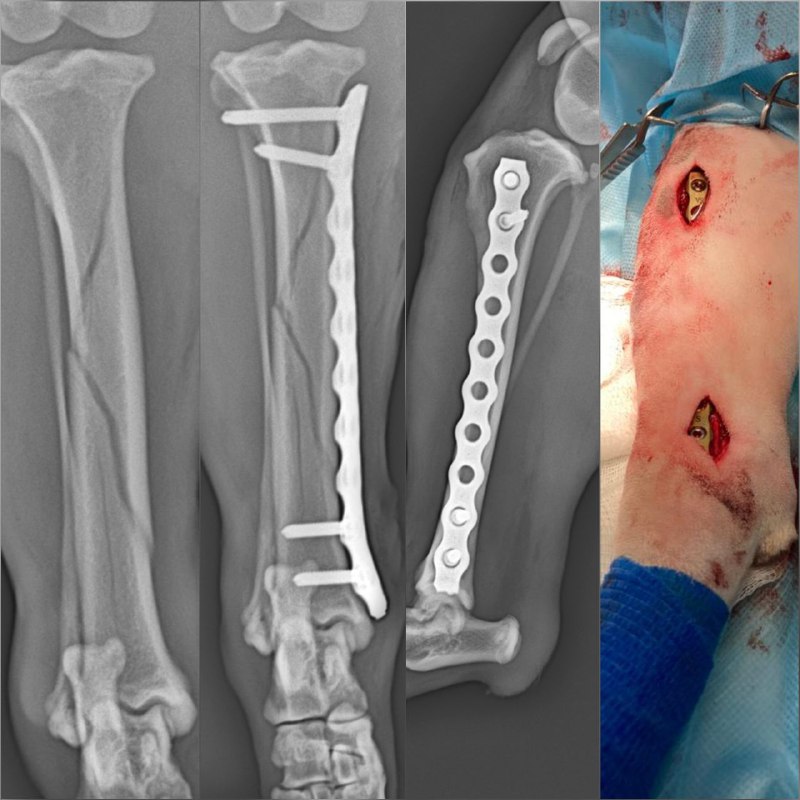 ***🟢***Clinical case #6