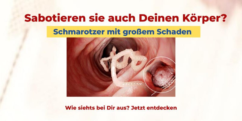 *****?*** Diese 8x-Schmarotzer musst Du kennen!**