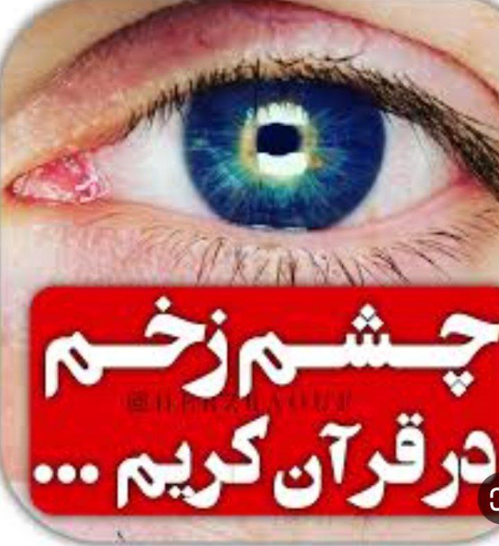 ?چشم نظر?