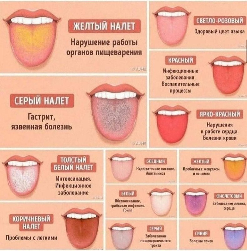 Цвет языка значит многое ***👅***