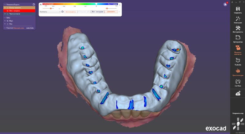 YZ dental technician