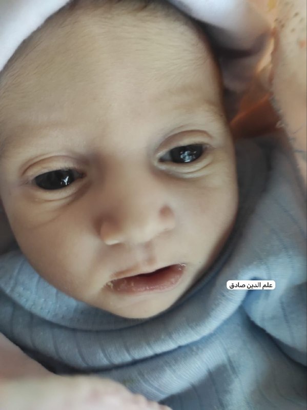 شُعلة الياسين