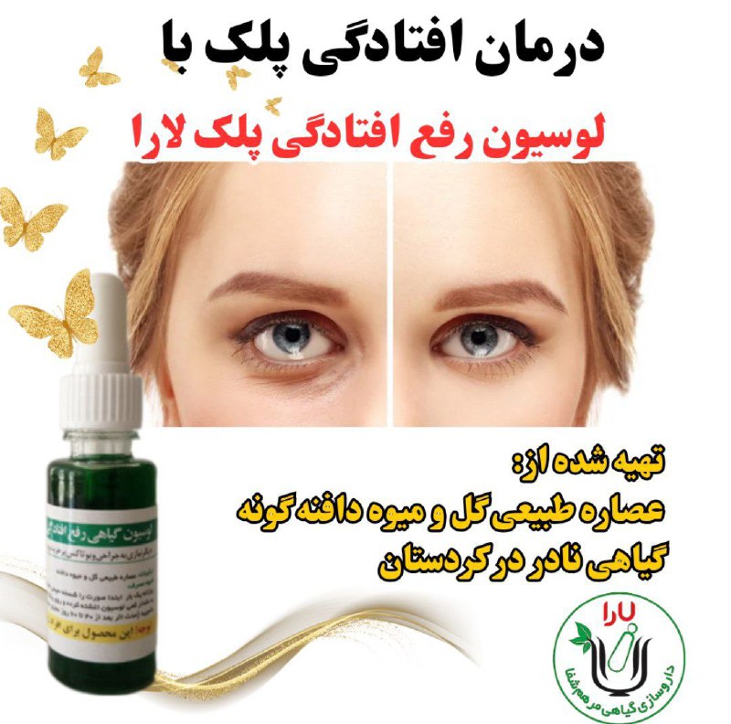 لوسیون گیاهی رفع افتادگی پلک مرهم …