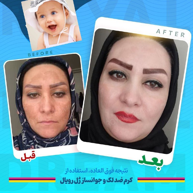 کانال کرمهای شمعدانی خانم مردانی