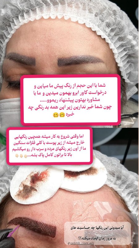 بهترین زمان برای ریموو فصل پاییز